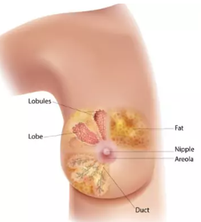 ব্রেস্ট ক্যান্সারের প্রাথমিক লক্ষণ 1 ব্রেস্ট ক্যান্সারের প্রাথমিক লক্ষণ